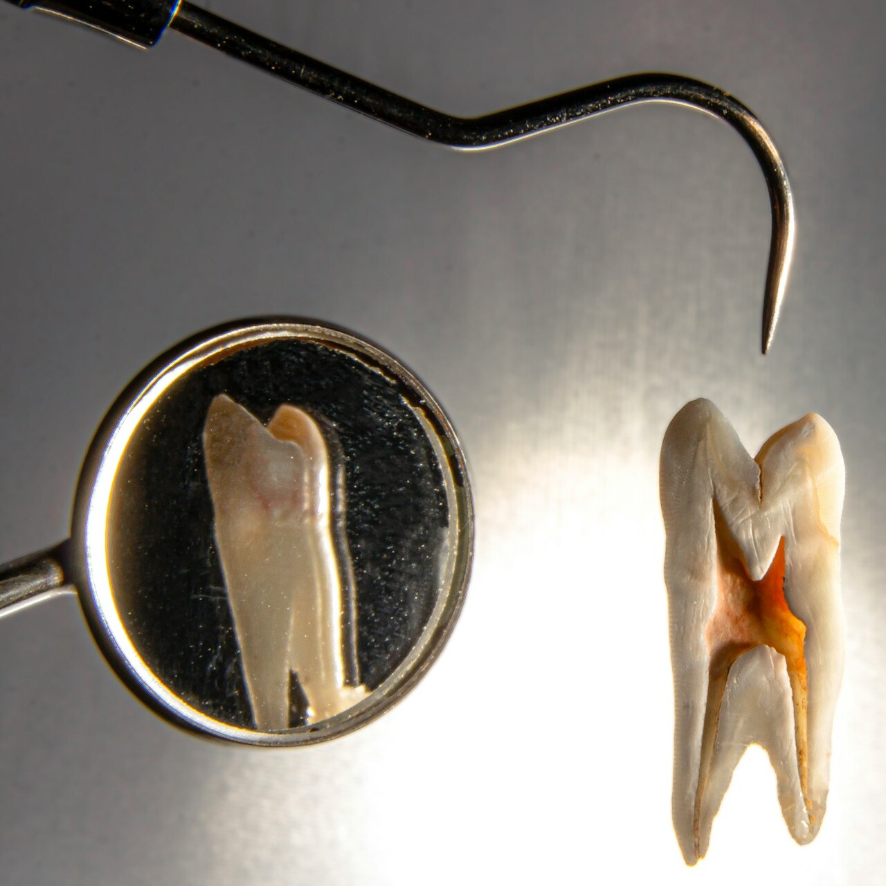 chirurgia orale estrazioni dentali